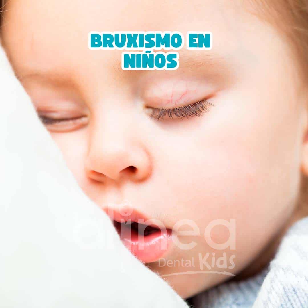 Bruxismo en Niños