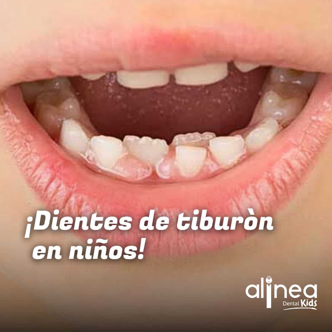 Dentista para niños