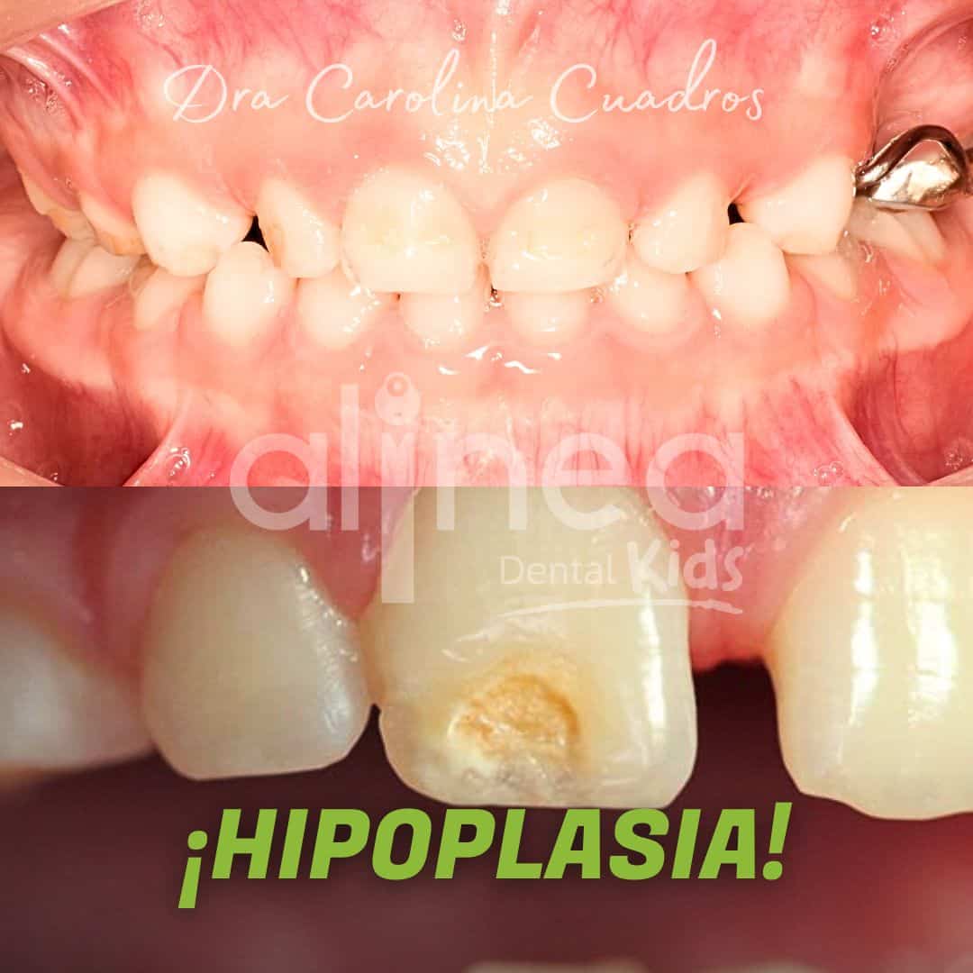Dentista para niños