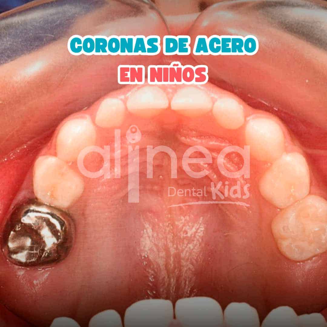 CORANAS DE ACERO_