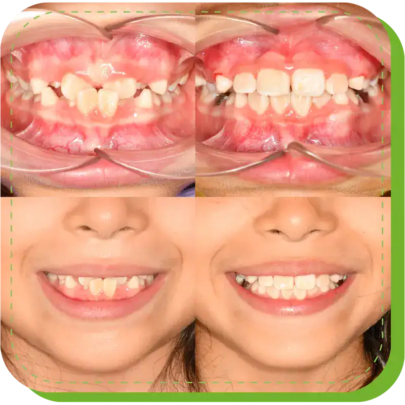 consultorio dental para niños lima peru 2