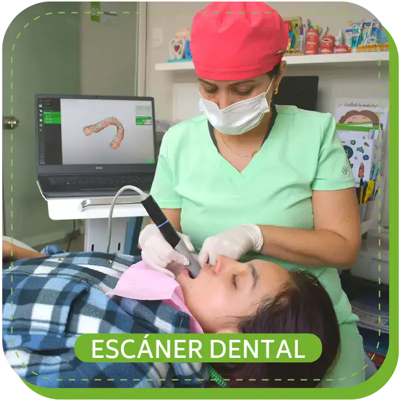 escaner dental odontopediatria lima surco 2