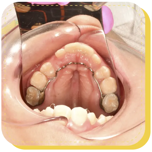 dentista especialista ortopedia infantil niños lima