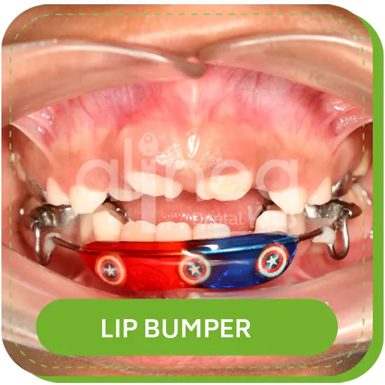 ortodoncia niños infantil LIP BUMPER lima