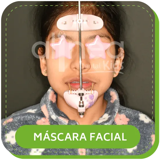 ortodoncia niños infantil MASCARA FACIAL lima