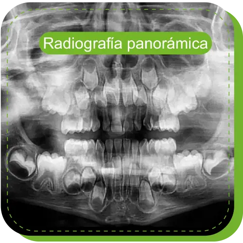 clinica odontopediatria con radiografia panoramica surco lima