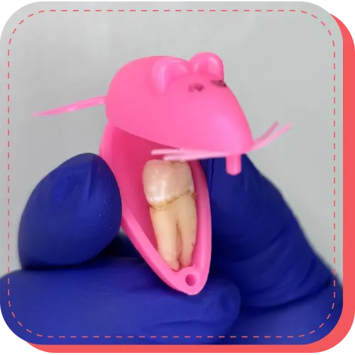 extraccion retiro de dientes surco lima