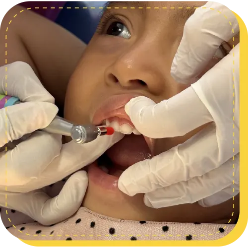 servicio profilaxis odontopediatra lima