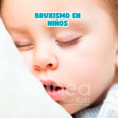 Bruxismo en Niños