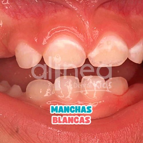 MANCHAS BLANCAS_