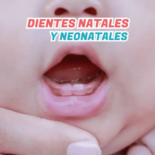 carolina cuadros jablinski odontopediatra habla sobre dientes natales neonatales