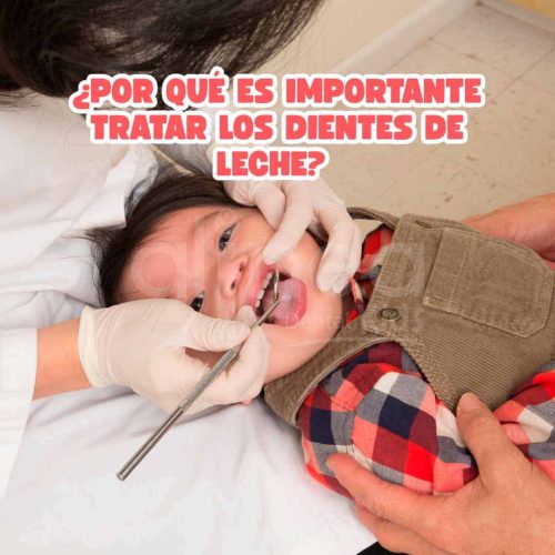 ¿Por qué es importante tratar los dientes de leche