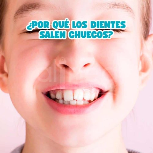 ¿Por qué los dientes salen chuecos?